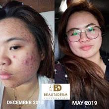 Load image into Gallery viewer, Regular Set - 60ml Toner ( Good for 2 months) plus FREEBIES ***HIGH DEMAND***