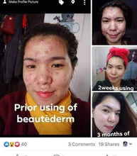 Load image into Gallery viewer, Regular Set - 60ml Toner ( Good for 2 months) plus FREEBIES ***HIGH DEMAND***