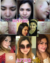 Load image into Gallery viewer, Regular Set - 60ml Toner ( Good for 2 months) plus FREEBIES ***HIGH DEMAND***