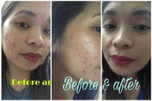 Load image into Gallery viewer, Regular Set - 60ml Toner ( Good for 2 months) plus FREEBIES ***HIGH DEMAND***