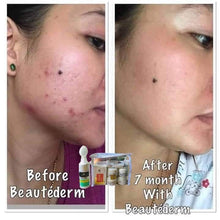 Load image into Gallery viewer, Regular Set - 60ml Toner ( Good for 2 months) plus FREEBIES ***HIGH DEMAND***