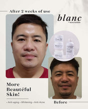 Load image into Gallery viewer, BLANC Rejuvinating SET ***High Demand) (2month use)