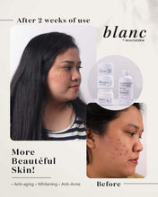 Load image into Gallery viewer, BLANC Rejuvinating SET ***High Demand) (2month use)
