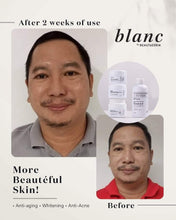 Load image into Gallery viewer, BLANC Rejuvinating SET ***High Demand) (2month use)