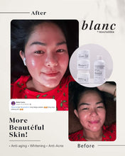 Load image into Gallery viewer, BLANC Rejuvinating SET ***High Demand) (2month use)