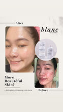 Load image into Gallery viewer, BLANC Rejuvinating SET ***High Demand) (2month use)
