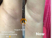 Load image into Gallery viewer, Underarm Whitening Set โผ๏ธ***ON DEMAND***โผ๏ธ