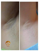Load image into Gallery viewer, Underarm Whitening Set โผ๏ธ***ON DEMAND***โผ๏ธ
