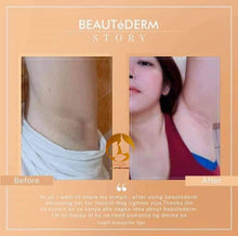 Load image into Gallery viewer, Underarm Whitening Set โผ๏ธ***ON DEMAND***โผ๏ธ