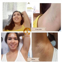 Load image into Gallery viewer, Underarm Whitening Set โผ๏ธ***ON DEMAND***โผ๏ธ