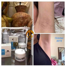 Load image into Gallery viewer, Underarm Whitening Set โผ๏ธ***ON DEMAND***โผ๏ธ