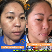 Load image into Gallery viewer, BLANC Rejuvinating SET ***High Demand) (2month use)